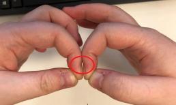 5 giây kiểm tra tay giúp phát hiện sớm nguy cơ mắc căn bệnh ung thư nguy hiểm bậc nhất, ai cũng có thể làm được!