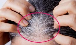 Thiếu vitamin nào sẽ gây ra tóc bạc ở cơ thể con người? Làm sao để ngăn tóc bạc xuất hiện?