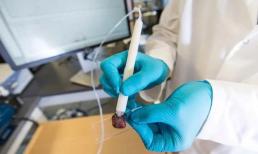 Chính thức thử nghiệm bút phát hiện ung thư chỉ trong 10 giây 