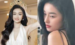 Nhận không ra nhan sắc của Hoa hậu Yến Nhi sau khi can thiệp thẩm mỹ