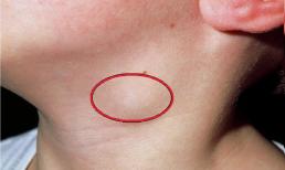 Chuyên gia y tế đưa ra cảnh báo, sáng sớm thấy 4 dấu hiệu này là tế bào K đang tấn công, ăn mòn cơ thể