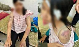 Bà nội và 2 người đàn ông đối diện án phạt nặng vì tra tấn dã man cháu gái 13 tuổi tại Thái Nguyên