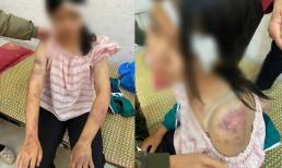 Vụ bé gái 13 tuổi bị bạo hành: Hé lộ kết quả giám định thương tích, 3 người thân bị khởi tố