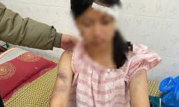 Bà ngoại bé gái 14 tuổi bị bà nội bạo hành dã man ở Thái Nguyên: Không một ai trong nhà biết chuyện chỉ tới khi báo chí đưa tin rầm rộ