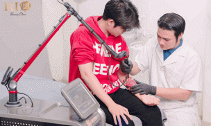 Xóa hình xăm ở đâu uy tín và không để lại sẹo?