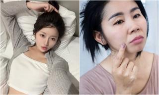 Tư thế ngủ khiến nếp nhăn ngày càng hằn sâu: Vậy ngủ sao cho đúng để da căng mịn, trẻ lâu?