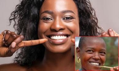 Tại sao người châu Phi hiếm khi dùng kem đánh răng mà răng vẫn trắng sáng?