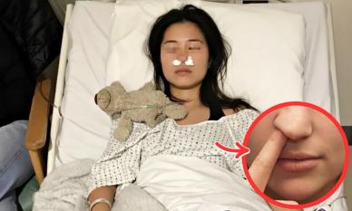 Người phụ nữ mọc cả đống nấm trong mũi vì thói quen 'vô tri' ai cũng từng làm