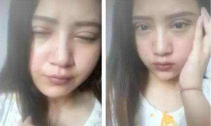 Tại sao không ủng hộ phụ nữ “cắt mắt 2 mí”. Chuyên gia nói “sự thật”