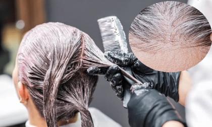 Người già nhiều tóc bạc có được nhuộm không? Được, nhưng tốt nhất không vượt quá con số này trong một năm