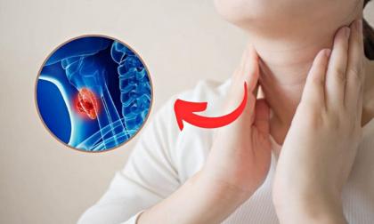 Căn bệnh ung thư phổ biến, nhiều người mắc thứ 7 thế giới: Người Việt dưới 40 tuổi mắc tăng gấp đôi trong 10 năm qua