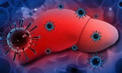 Loại virus ‘sát thủ’ lây nhanh gấp 100 lần HIV: Việt Nam thuộc nhóm có tỷ lệ nhiễm cao nhất khu vực