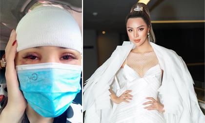 Siêu mẫu Khả Trang bị tai nạn không thể tham gia Seoul Fashion Week 