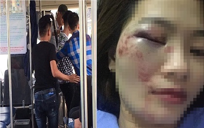 Khởi tố vụ nữ phụ xe buýt bị 5 thanh niên hành hung đúng ngày 20/10