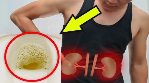 Người thận xấu thường có 5 hiện tượng vào buổi sáng: Nếu bạn không có thì xin chúc mừng, thận bạn rất khỏe mạnh