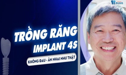 Bỏ ra 200 triệu đi trồng răng Implant có xứng đáng không?