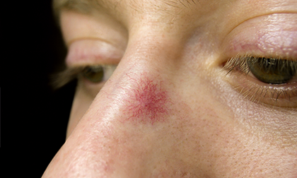 Bước qua tuổi 40, có 4 dấu hiệu cảnh báo ung thư không thể không đề phòng