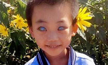 Cậu bé sinh ra với 'đôi mắt ác quỷ' bị cha ruột bỏ rơi khi mới 4 tháng tuổi