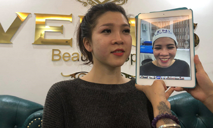 Trẻ ra 10 tuổi chỉ sau 60 phút bằng Tái sinh đa tầng tại TMV Quốc tế Venus