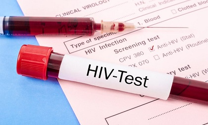 Các triệu chứng của thời kỳ ủ bệnh AIDS là gì và làm thế nào để sàng lọc xét nghiệm AIDS?