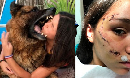 Chơi trội cho đầu vào mồm chó tự sướng, cô gái nhận hậu quả khâu 40 mũi