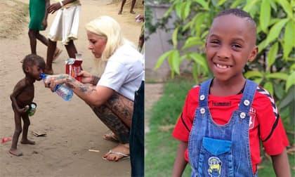 Cậu bé 'da bọc xương' từng gây ám ảnh cả thế giới giờ có cuộc sống ra sao?