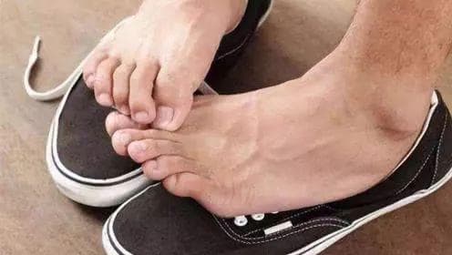 Mang giày chân trần vào mùa hè tương đương với việc không giặt đồ lót