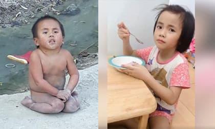 Sau 3 năm được nhận nuôi, em bé Mường Lát bị liệt cả 2 chân giờ ra sao?