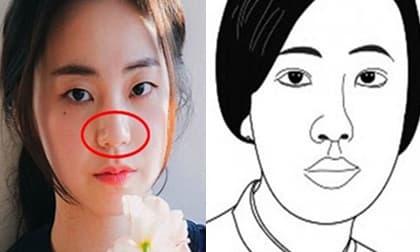 3 tướng mũi không đẹp nhưng là 'phúc trời ban', đừng dại động chạm dao kéo mà cắt đứt tài lộc