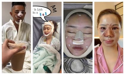 Nhìn hình ảnh những sao Việt này lúc thẩm mĩ khiến công chúng chỉ muốn 'chạy mất dép'