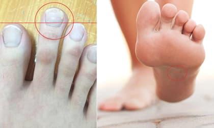 Tướng bàn chân đàn ông may mắn, dễ làm quan to, cả đời sung sướng