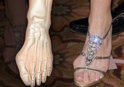 4 loại giày được công nhận là 'đau chân nhất'! Cái số 4 cả nam và nữ đang đi rất nhiều