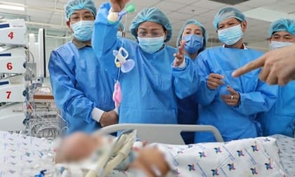 Phẫu thuật tách rời hai bé song sinh dính liền: Trúc Nhi còn yếu, vẫn phải thở máy