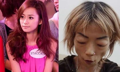 Uống thuốc giảm cân vì bị chồng chê béo, sao TVB trở thành bộ xương mục ruỗng, nhận kết cục thê lương