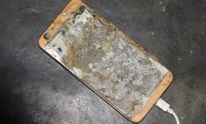 Nổ điện thoại khi vừa dùng vừa sạc pin, thanh niên bị cháy bỏng toàn thân