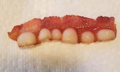 Cô gái khoe thành quả chiên thịt xông khói như phim kinh dị, vì ai cũng tưởng cả mảng lợi bị rớt