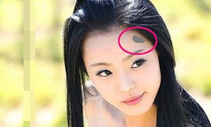 Người có vết bớt ở 4 vị trí sau đây có thể hoàn thành được những việc lớn, cả đời càng giàu sang phú quý!