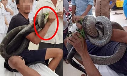 Người đàn ông bị rắn cắn, quấn chặt vào cánh tay - hình ảnh ở phòng cấp cứu khiến tất cả hoảng sợ