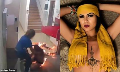 Nữ người mẫu bốc cháy như đuốc sau trận cãi vã với người yêu đồng giới