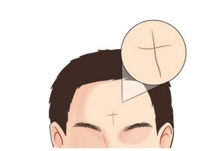 4 đường trên trán của bạn sẽ cho bạn biết sự giàu có và phước lành của cuộc sống của bạn! Xem nếu bạn có nó!