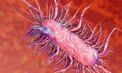 Người phụ nữ ở Hà Nội suýt tử vong vì mắc bệnh Whitmore