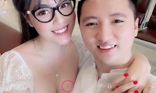 Nốt ruồi ở ngực có ý nghĩa 'phú quý' như thế nào mà Trọng Hưng 'bóc phốt' vợ cũ Âu Hà My là làm giả?