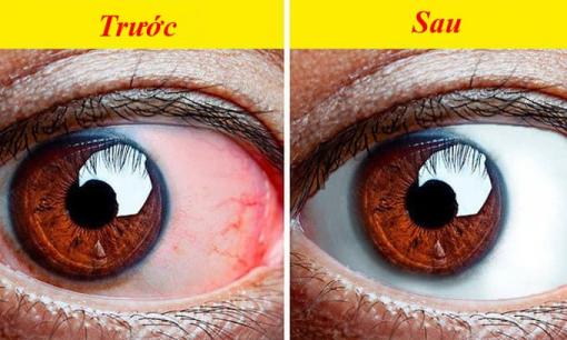 8 bài tập mà những người bị mỏi mắt cần phải làm