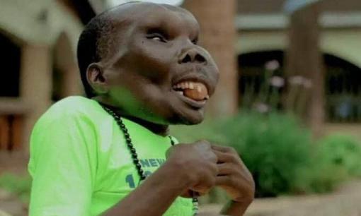 'Người đàn ông xấu xí nhất thế giới' khiến tất cả ngỡ ngàng khi tuyên bố kết hôn lần 3