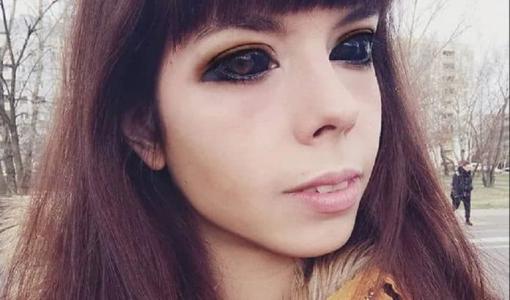 Cô gái bị mù sau khi xăm mực đen lên mắt để có vẻ ngoài giống thần tượng 