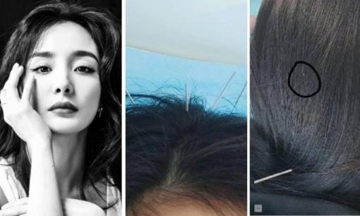 Dương Mịch gây choáng khi cắm đầy kim trên đầu, dân mạng tinh mắt còn soi ra chi tiết siêu nhỏ này 