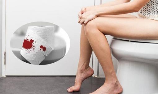 Phải làm gì nếu không thể đi đại tiện và ra nhiều máu sau khi sinh con?