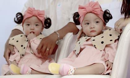 Ngắm Song Nhi vui vẻ đáng yêu trong ngày xuất viện