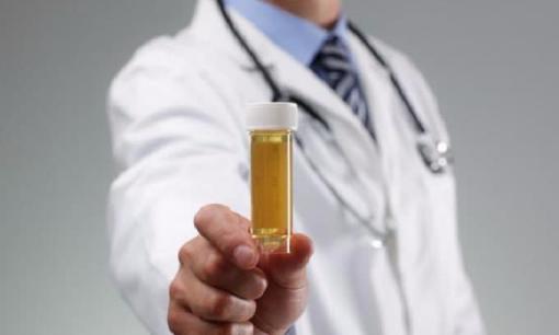 Đi tiểu màu vàng và có mùi hôi, cơ thể đang “gợi ý” một số bệnh cho bạn, đừng bỏ qua!