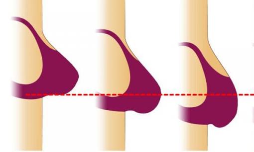 9 đồ vật thường dùng ảnh hưởng trực tiếp đến tuổi trẻ và nhan sắc của bất kỳ phụ nữ nào